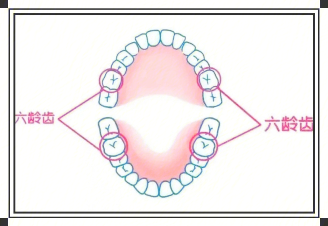 为什么要保护儿童的六龄齿
