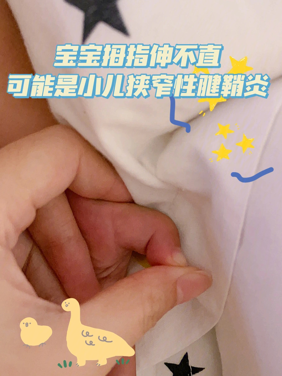 幼儿狭窄性腱鞘炎图片