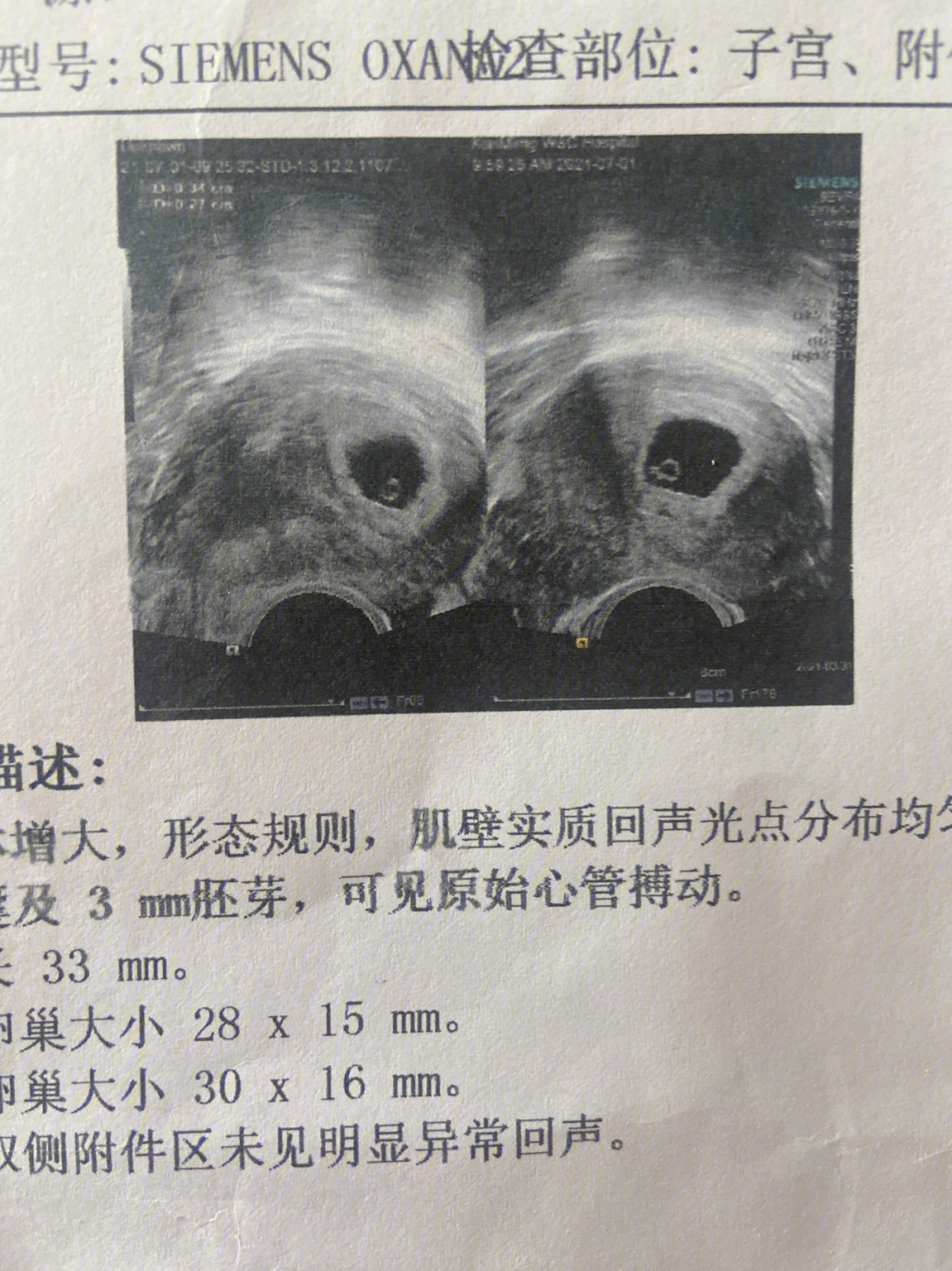 胎心胎芽几周能查出来图片