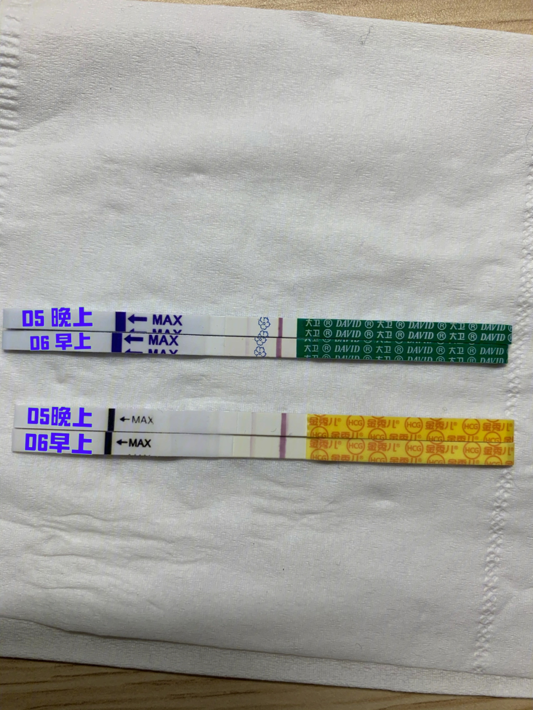 特尔津灌注图片