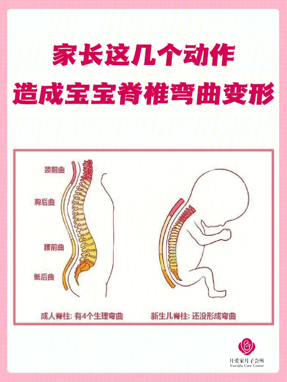 胎儿仰卧位正确图片图片