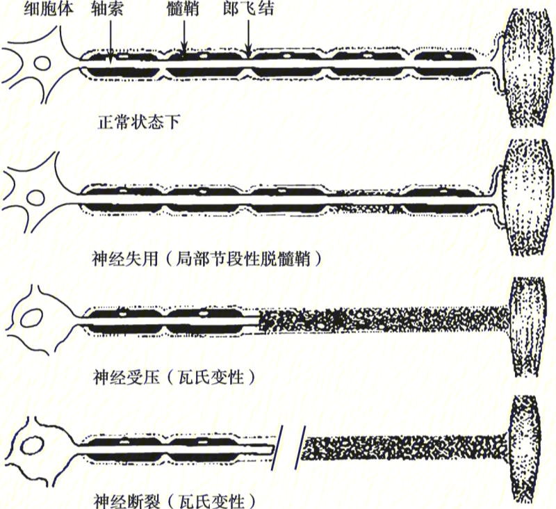 双下肢肌电图图片