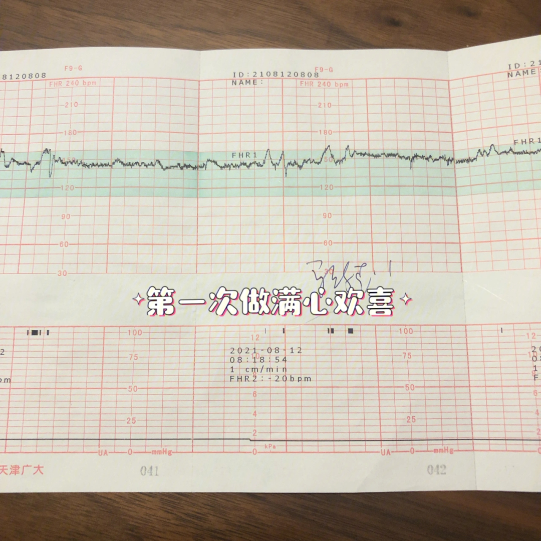 胎心监护合格图片图片