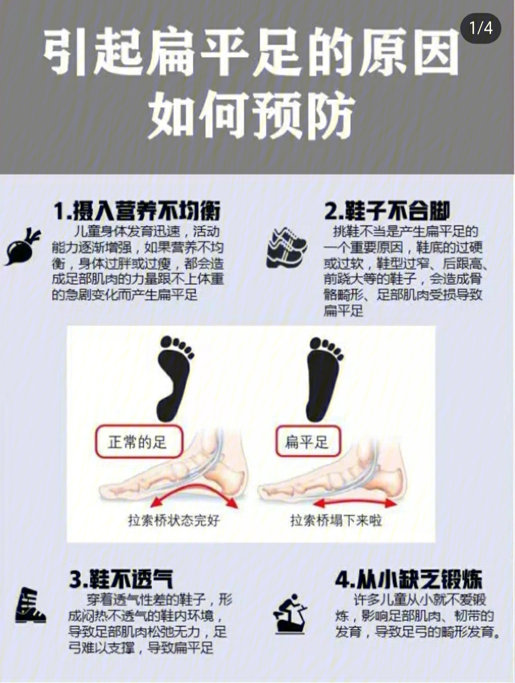 走路内八字,鞋底内侧磨损比较厉害;3经常小腿后侧酸痛;4