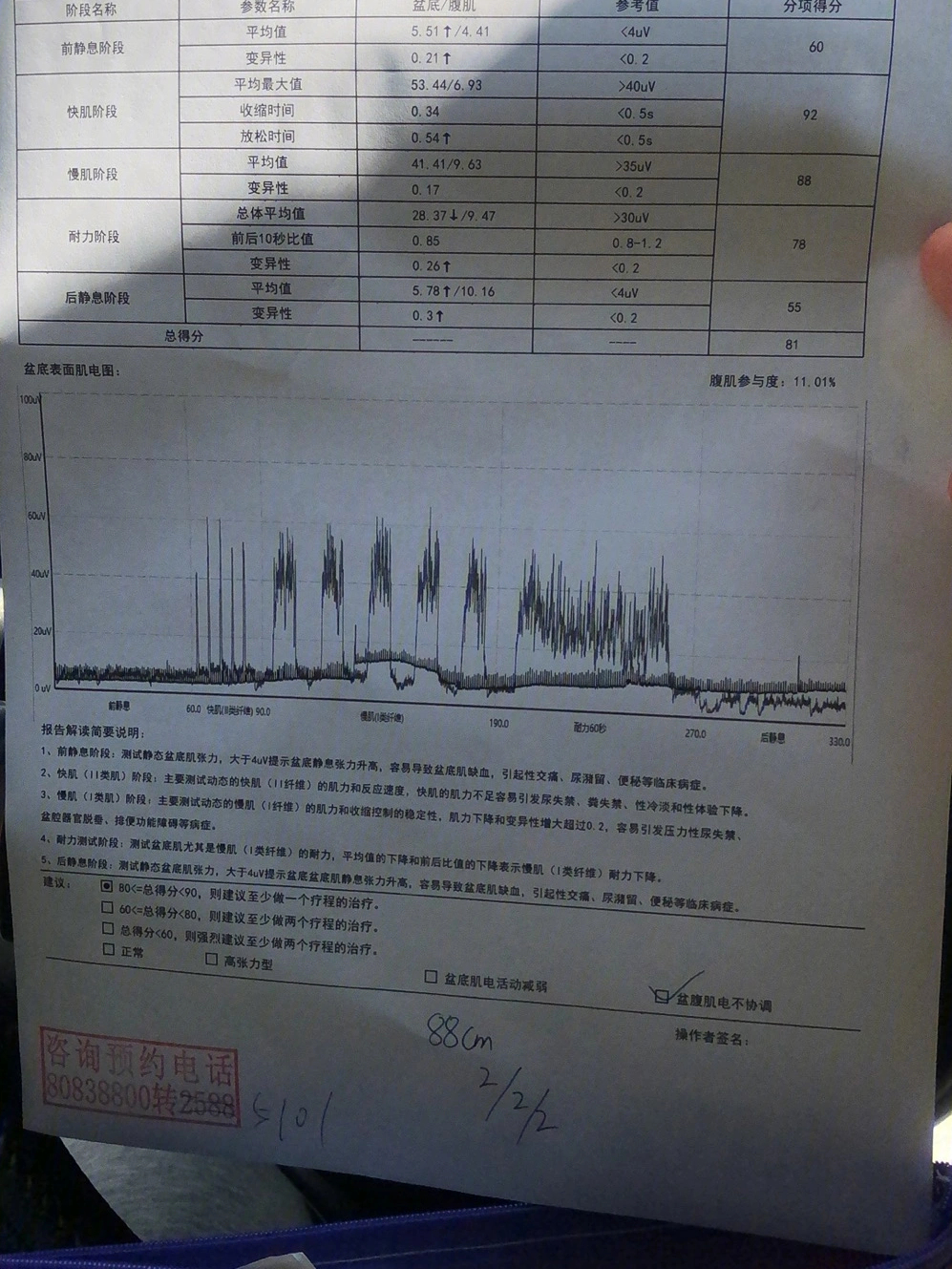 白带常规正常值图图片