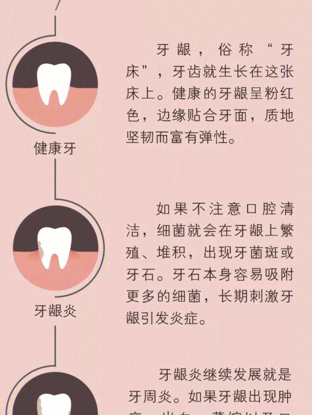 牙龈肿怎么回事图片