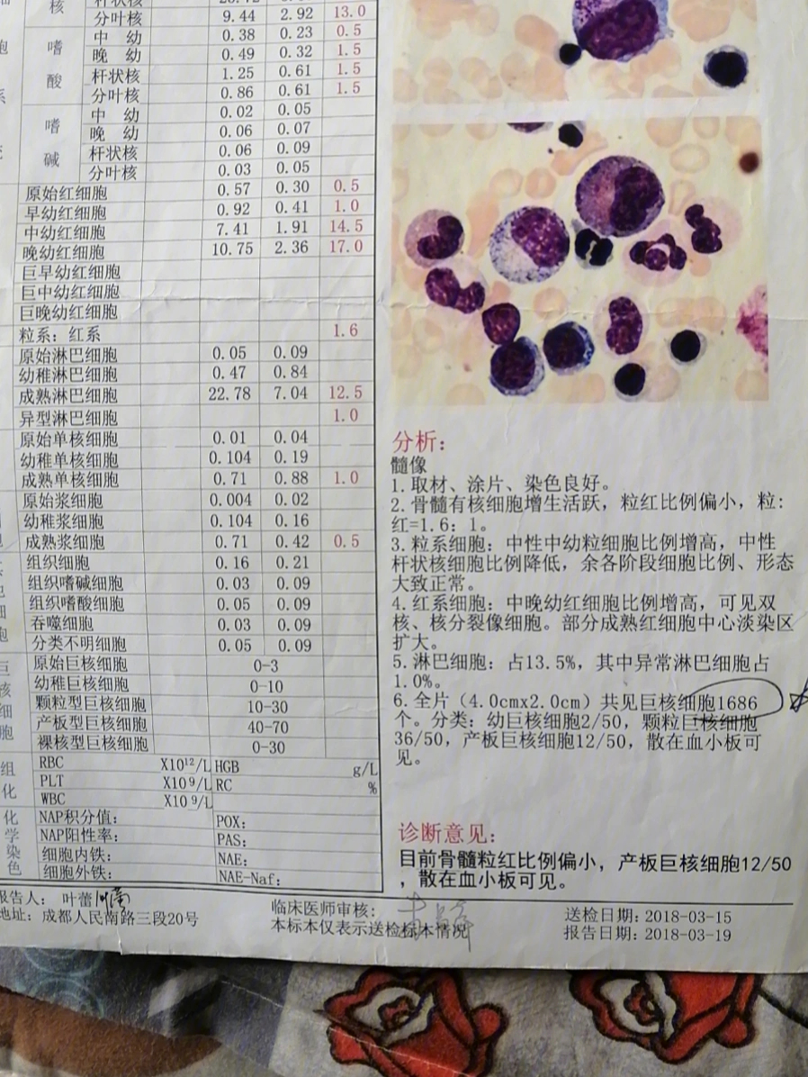 紫癜骨髓图片