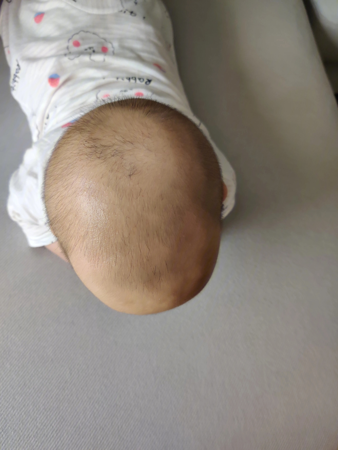 四个月宝宝枕秃图片图片