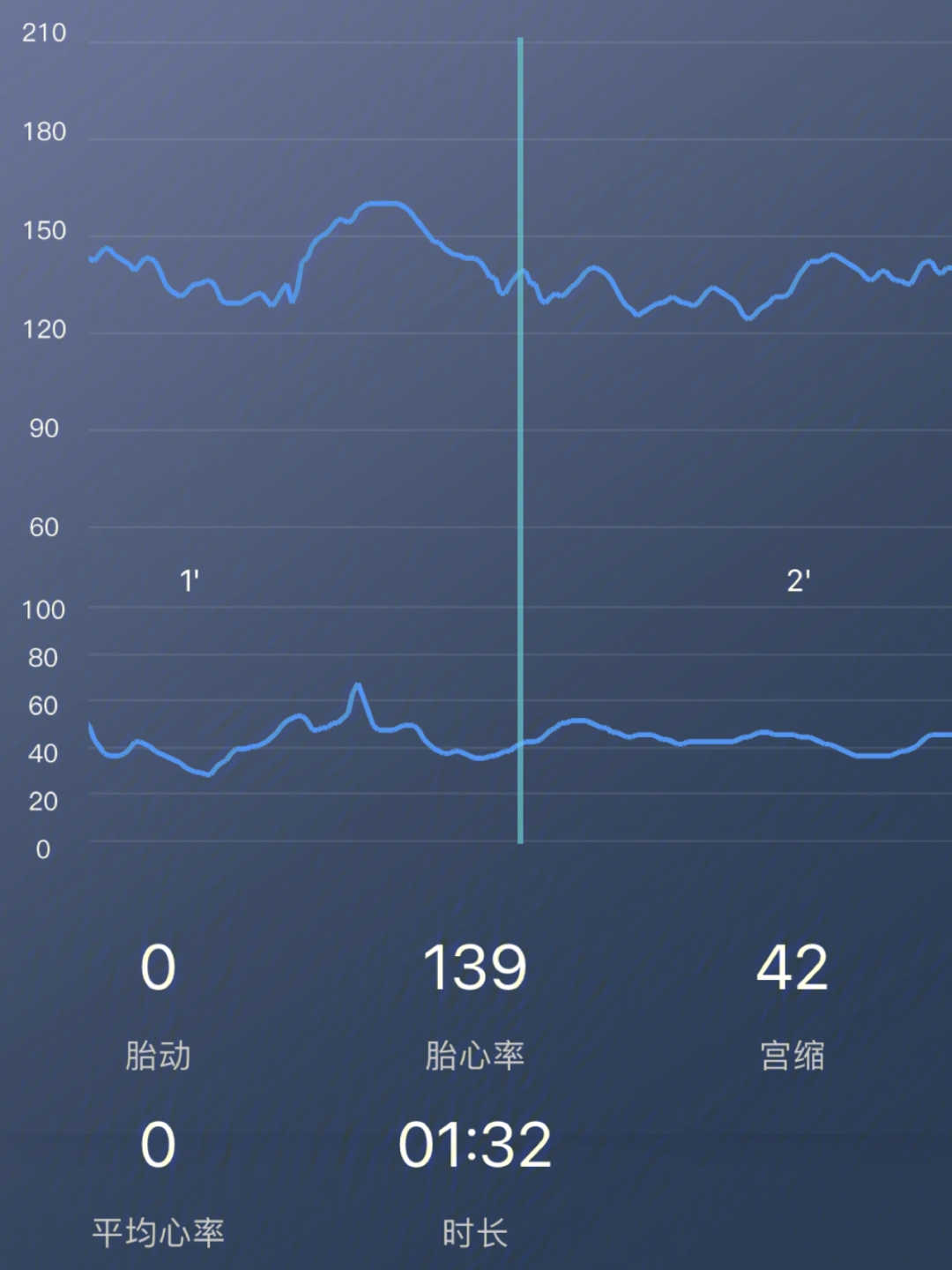 对于准妈妈来说最美好的声音是胎心音