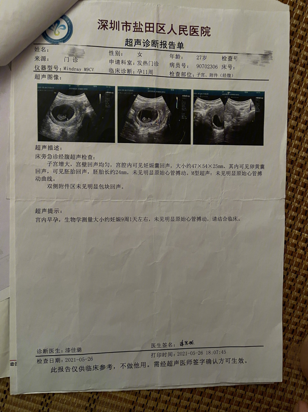 医院打胎的单子图片图片