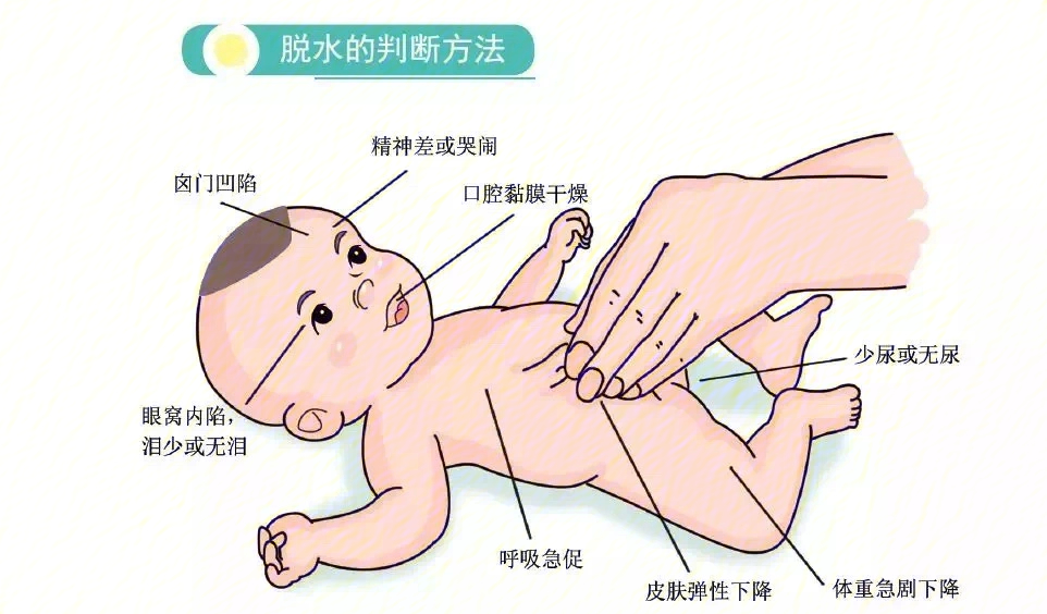 婴儿脱水症状图片图片