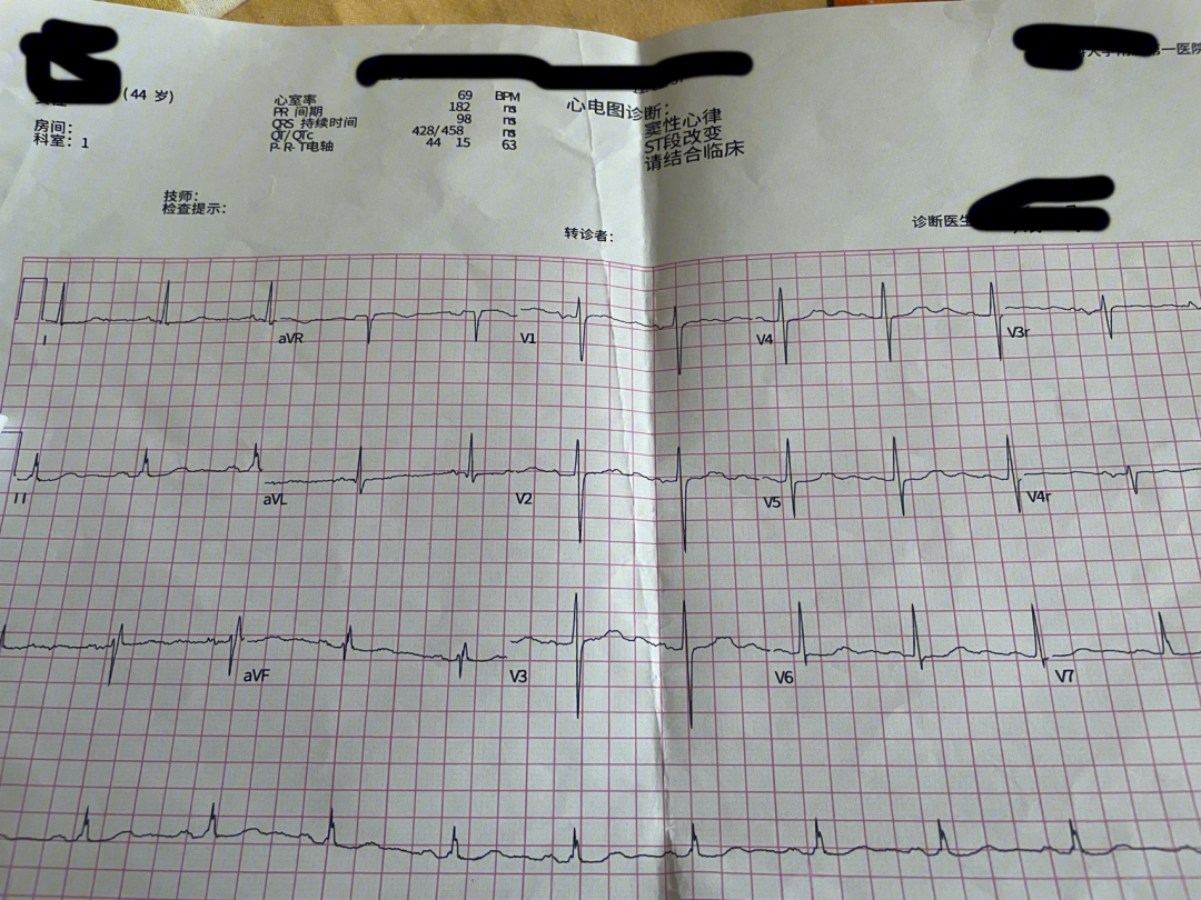 本来准备按照医生说的做穿刺手术,结果医生看到心电图的时候发现有