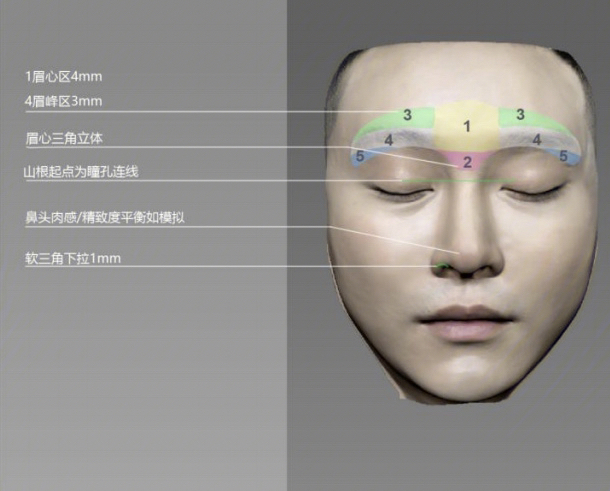3d打印眉弓,根据采集到的额骨,眉弓骨的高度,弧度,软组织厚度,设计