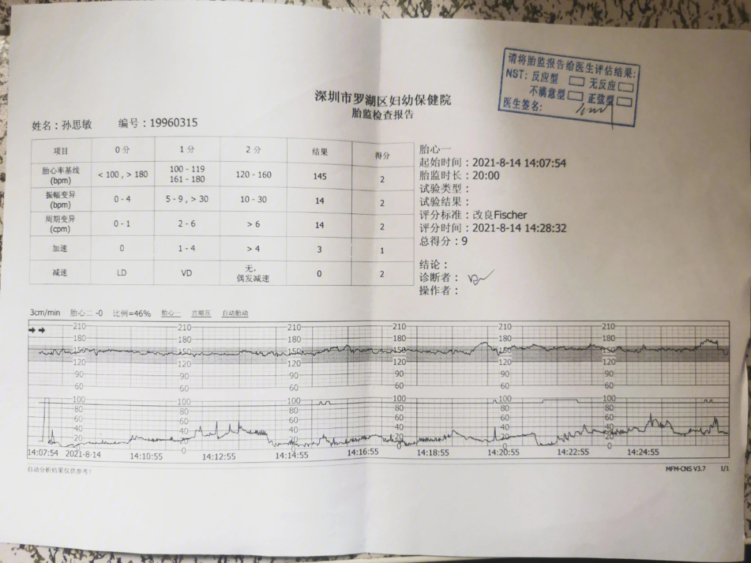 胎心监护合格图片图片