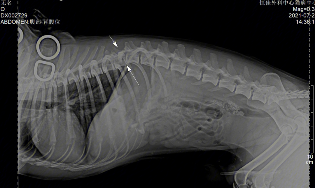 犬脊柱骨折