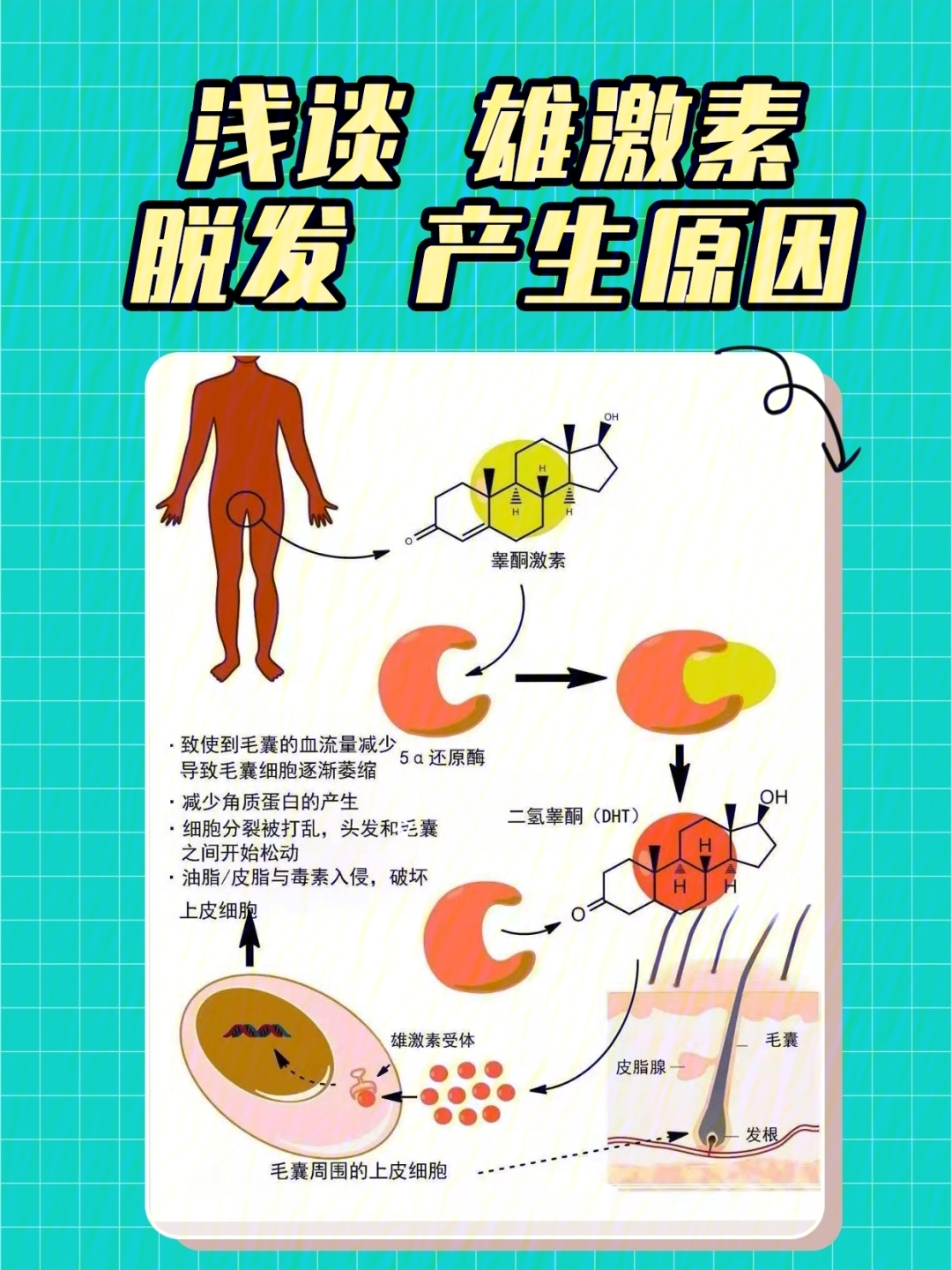 植发医生浅谈雄激素脱发产生原因