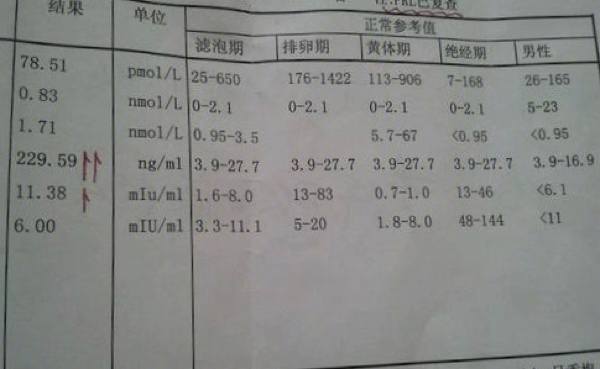 泌乳素高会导致什么图片