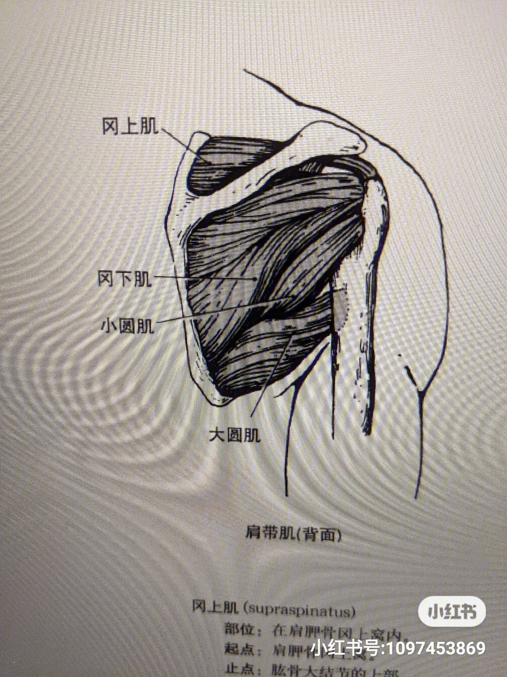 岗上肌肱二头肌肌腱炎!康复心得