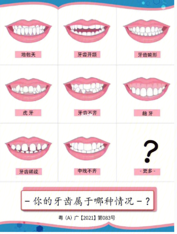 矫正牙齿价目表 儿童图片