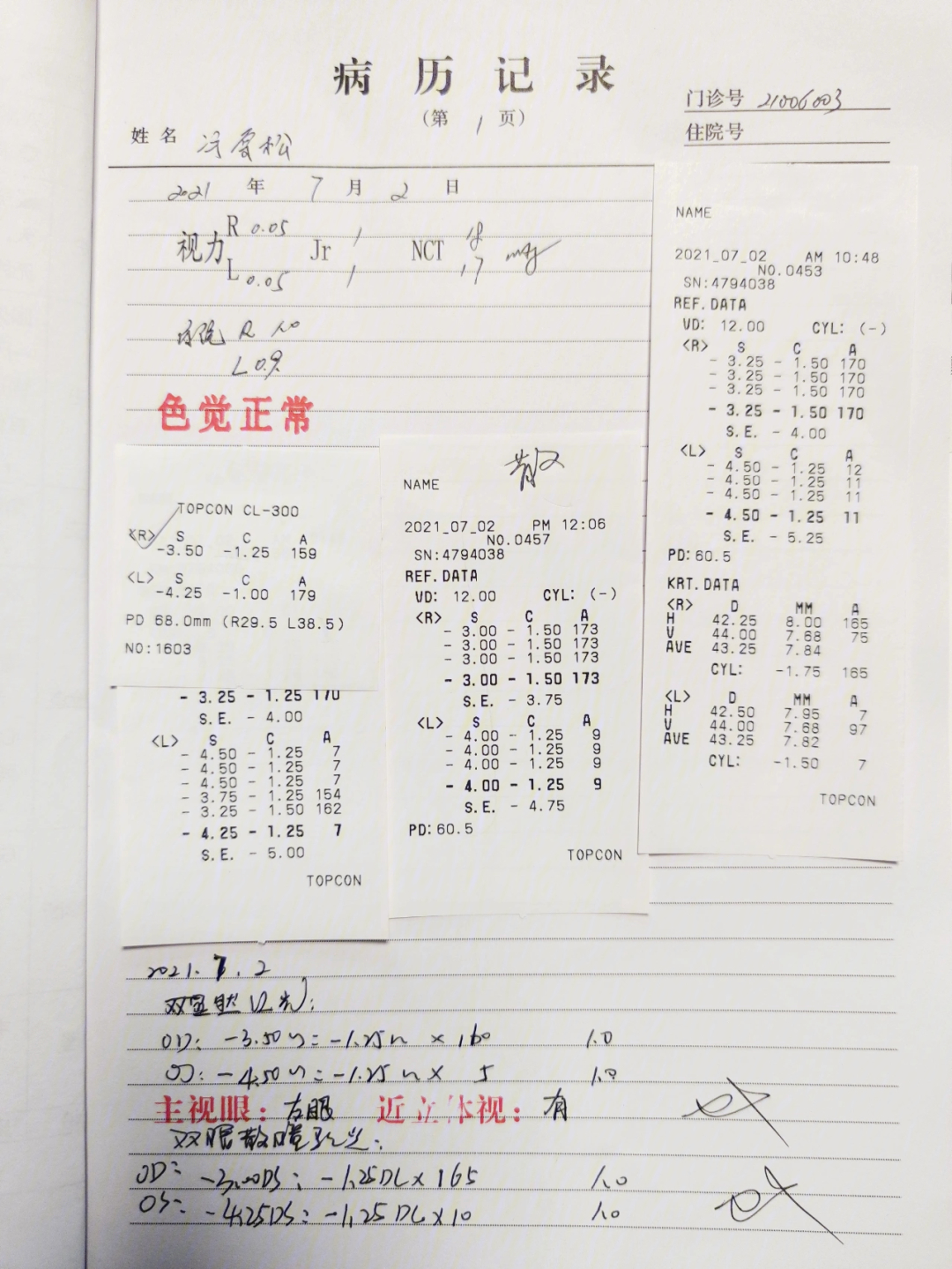 全飞秒手术病例分享