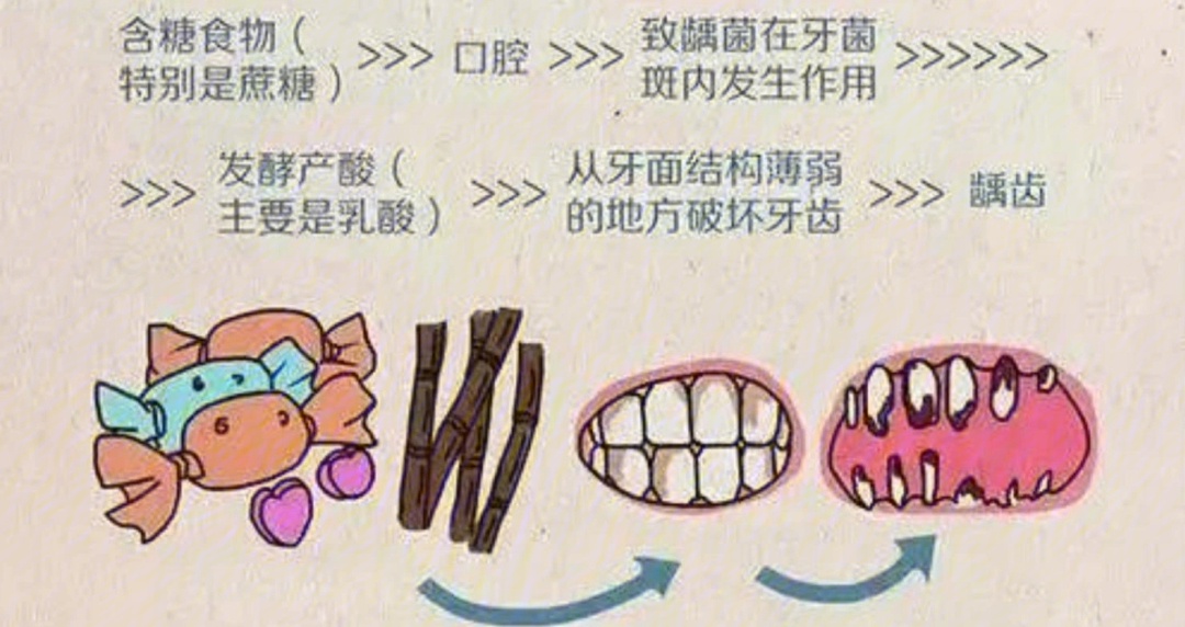 蛀牙的原因卡通图片