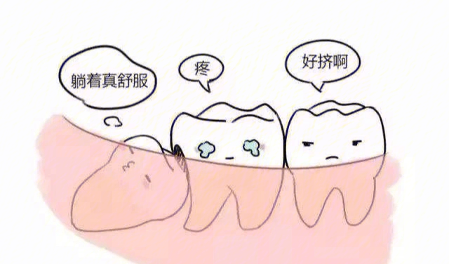 第三磨牙是什么位置图片