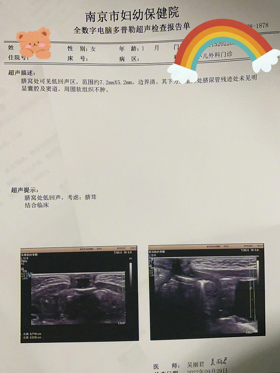 求南京有没有不手术治疗脐茸的医院