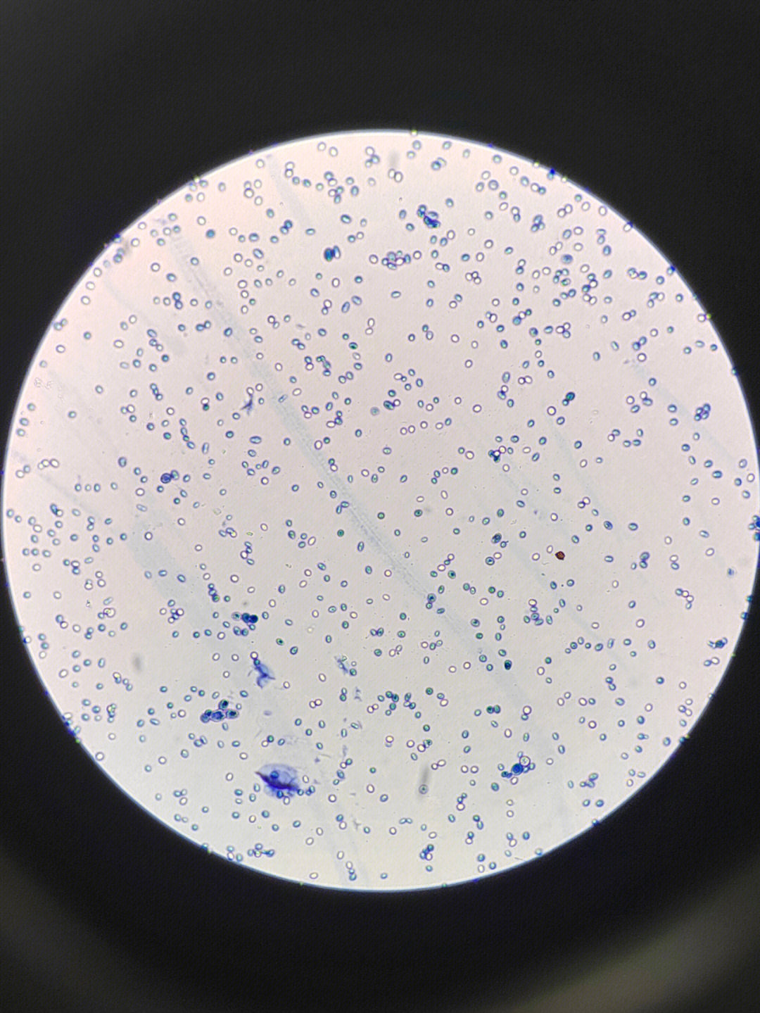 吕氏碱性美蓝不同浓度 作用时间 下酵母菌