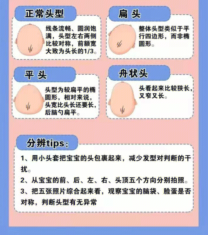 婴儿方颅 正常图片