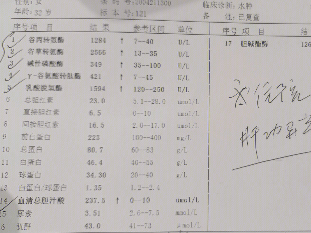 谷丙转氨酶1000多谷草2000多急性肝损伤