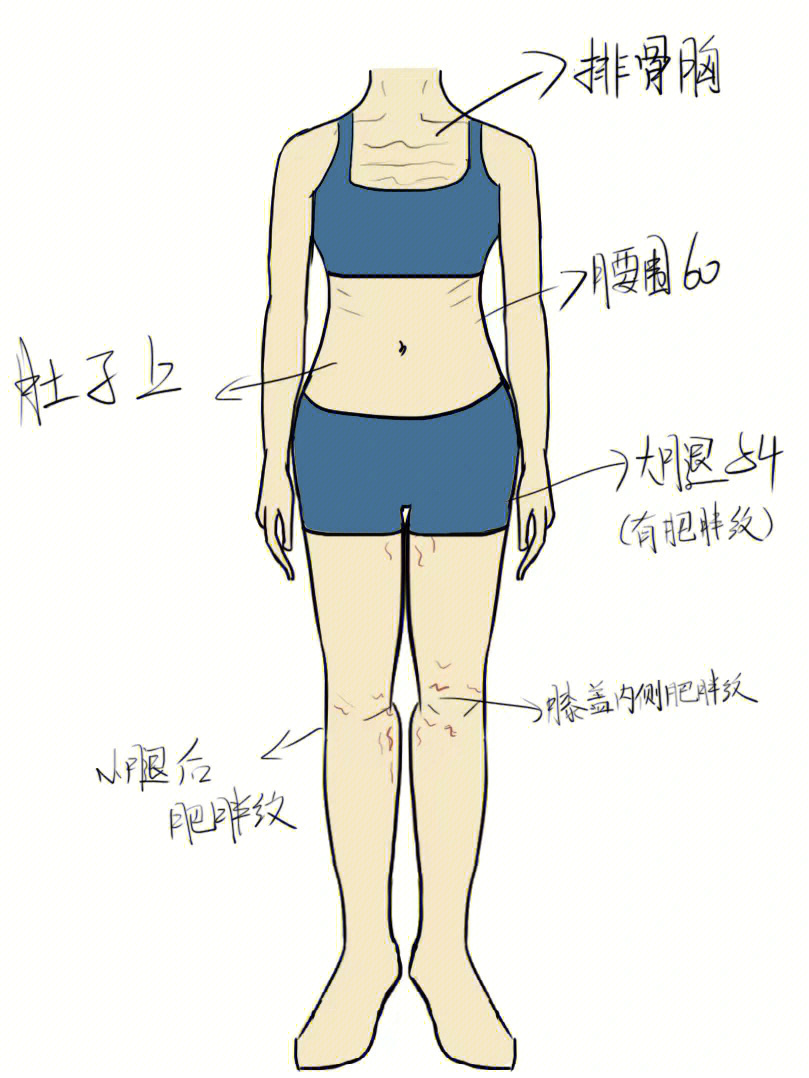 肥胖纹怎么消除去掉图片