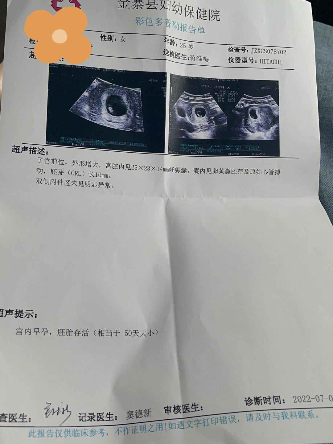 16周听胎心的位置图片图片