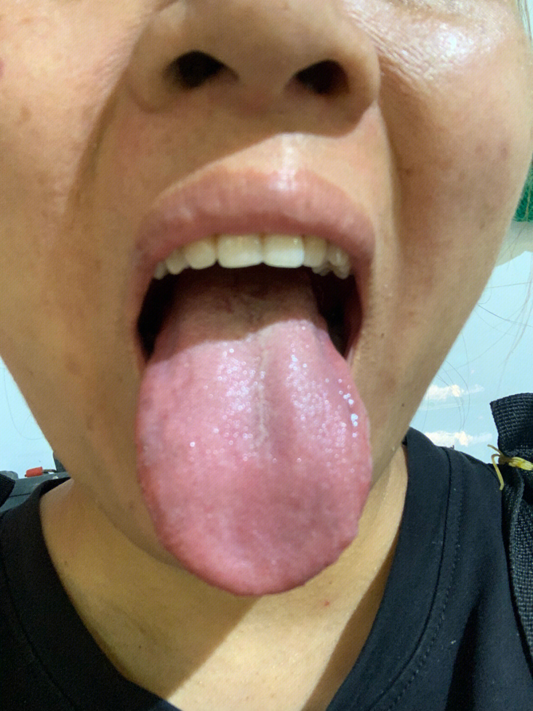 这样的舌苔你知道怎么调理吗
