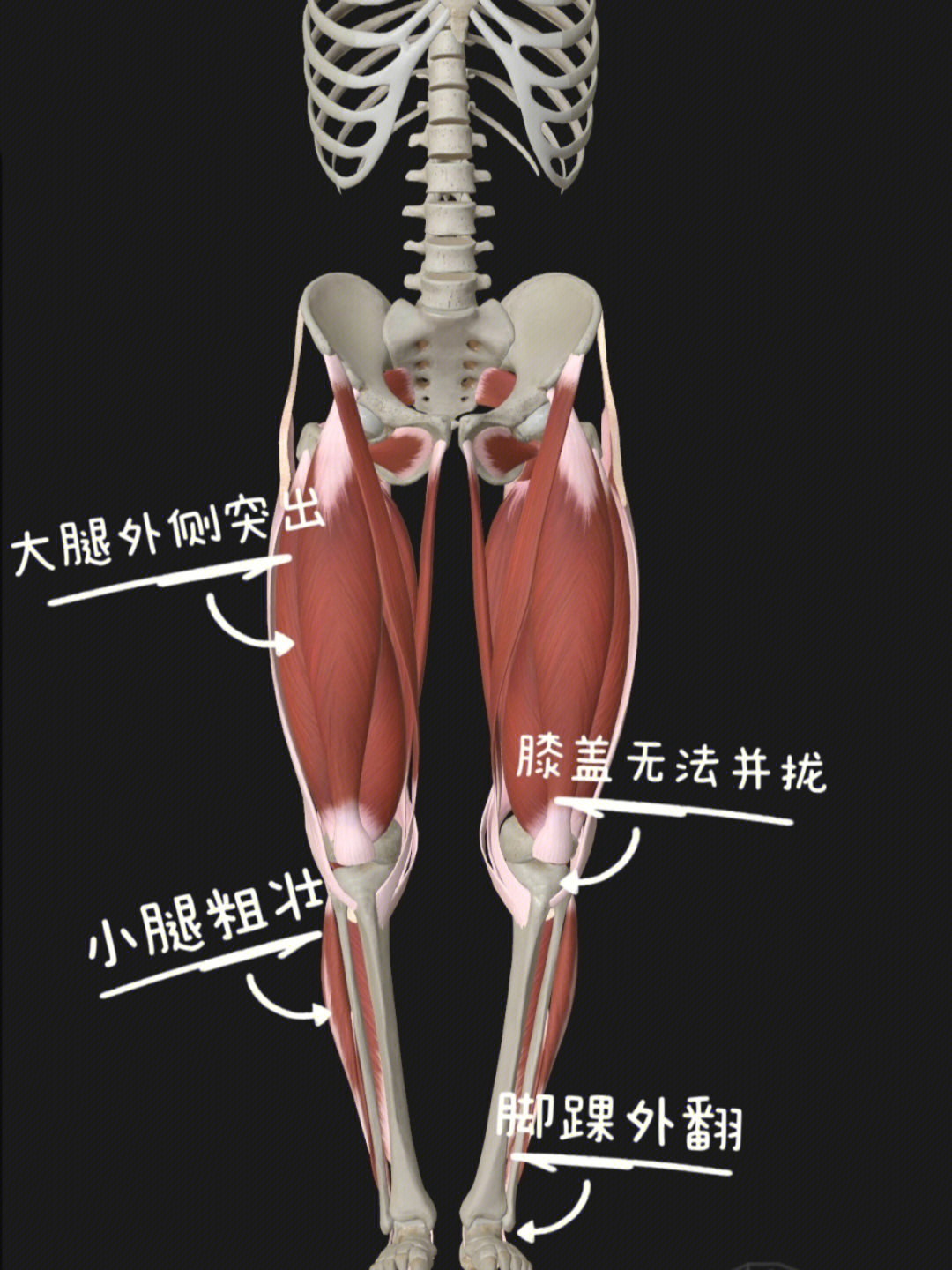 大腿内旋外旋示意图图片