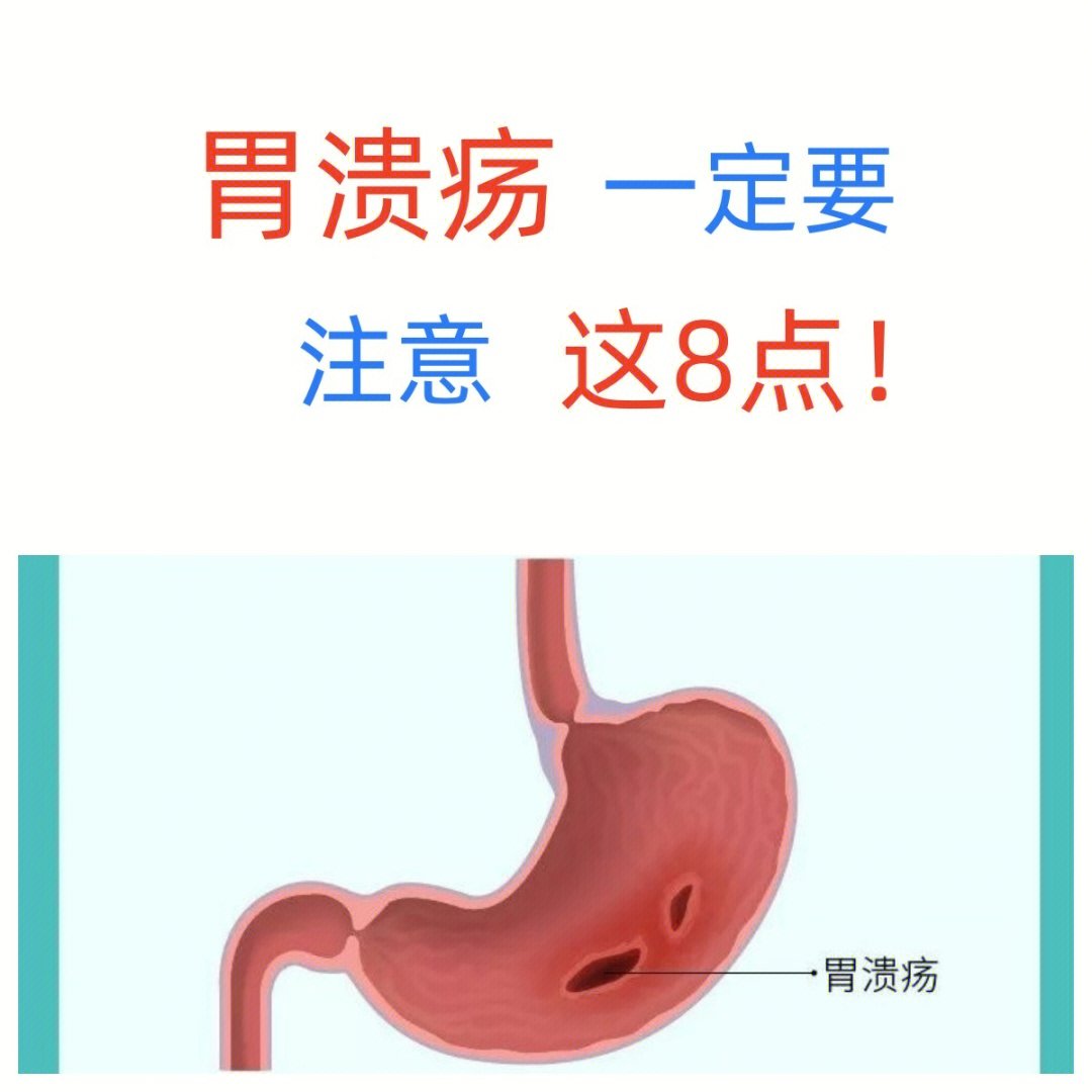 胃溃疡怎么读 小红书