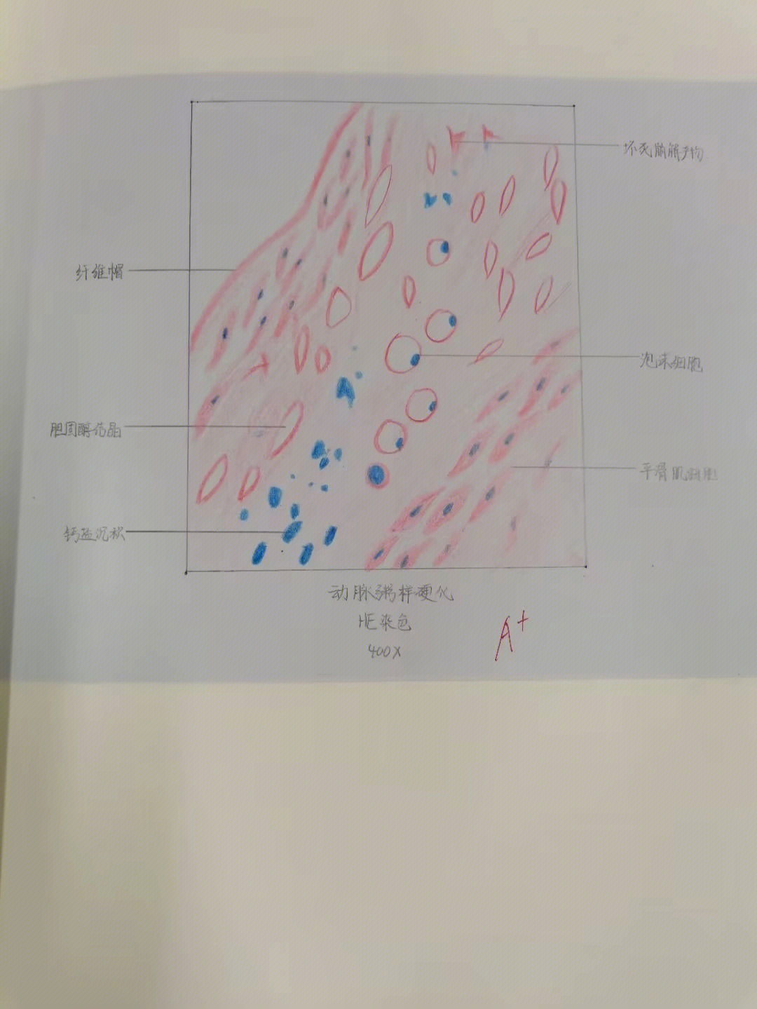 浆细胞红蓝铅笔绘图图片