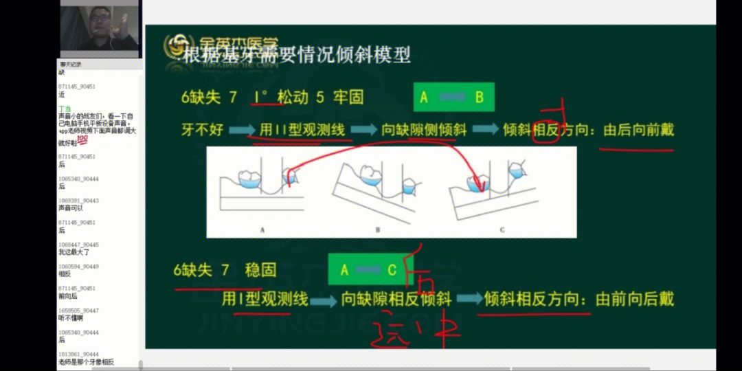 口腔观测线分类图解图片