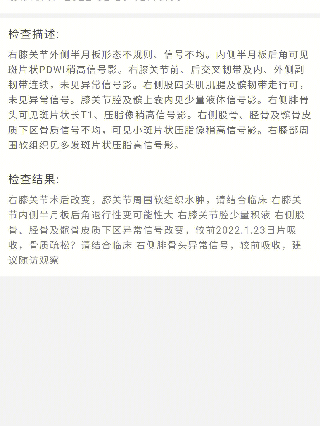 盘状半月板发病率图片