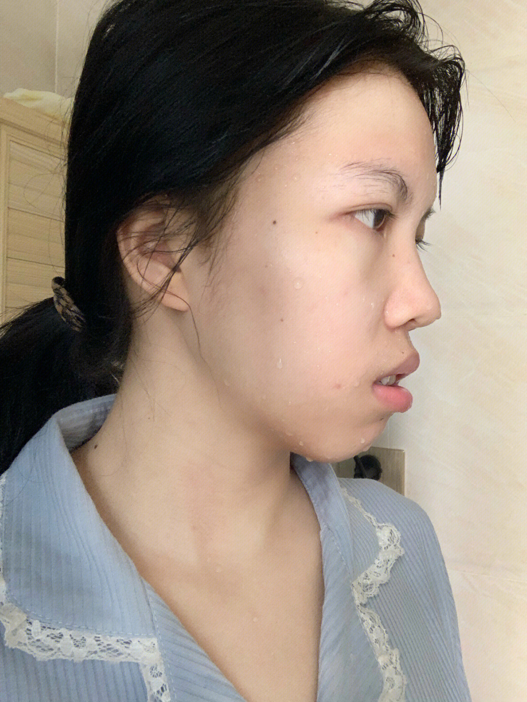 正颌手术脸型图片