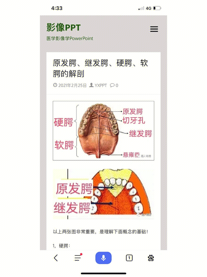 腭裂一度图片