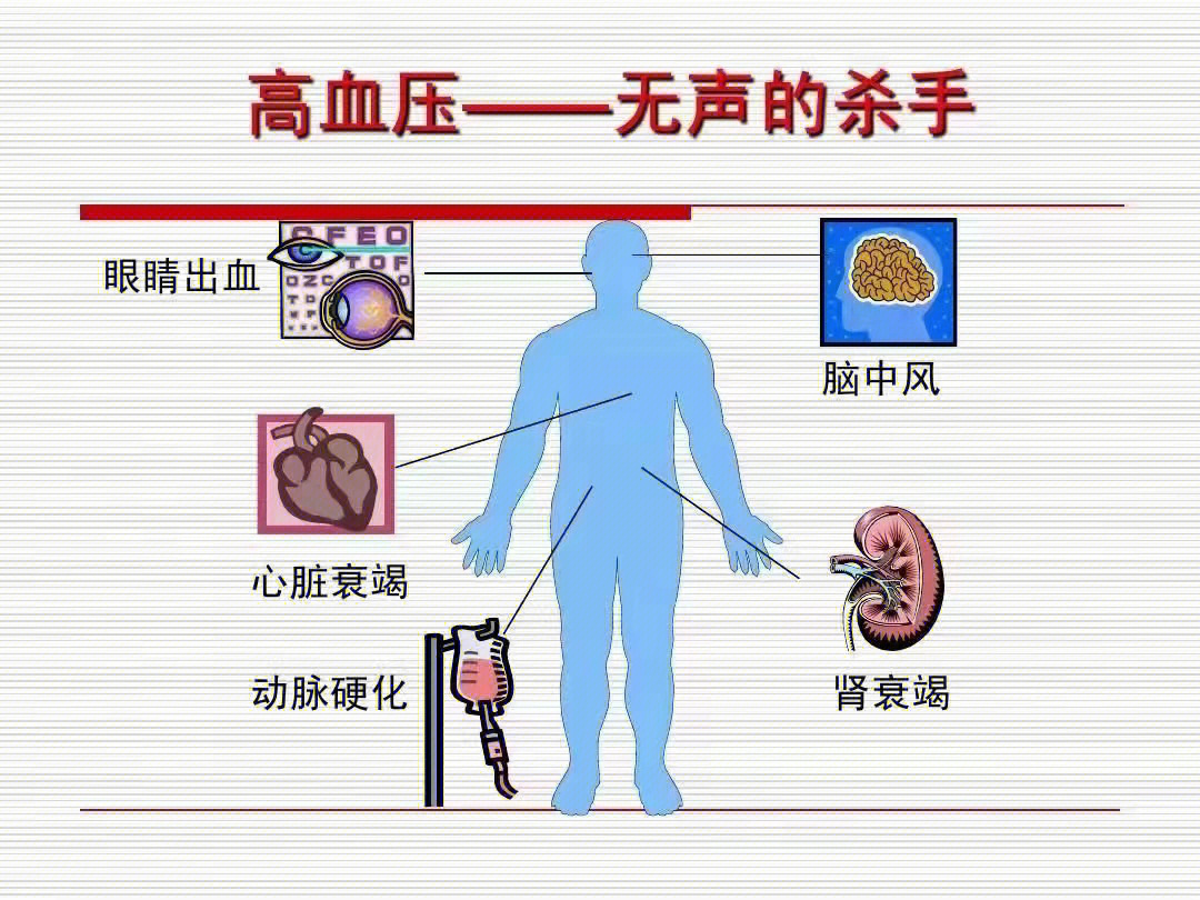 血管一撑开,那么血压降了么?降了!血粘稠解决了么?