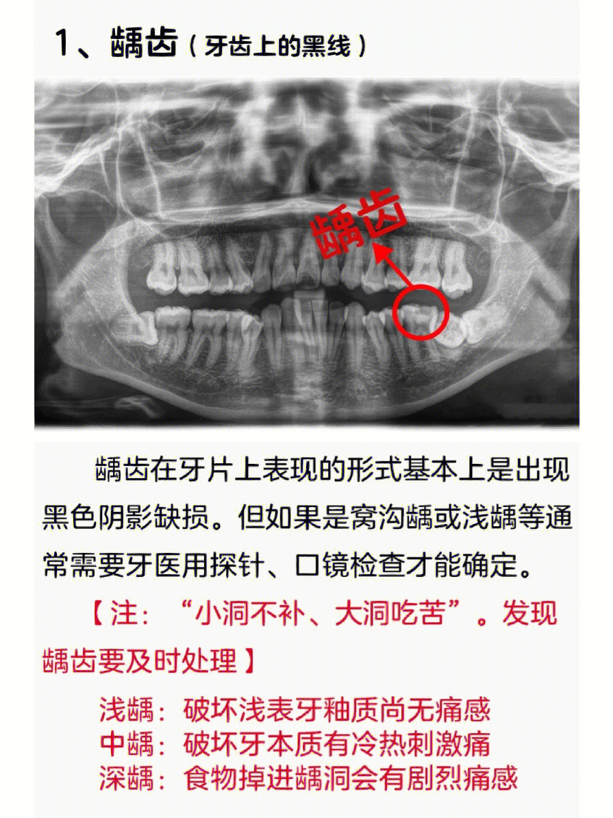 73硕士牙医教你8张图看懂全口牙齿问题60