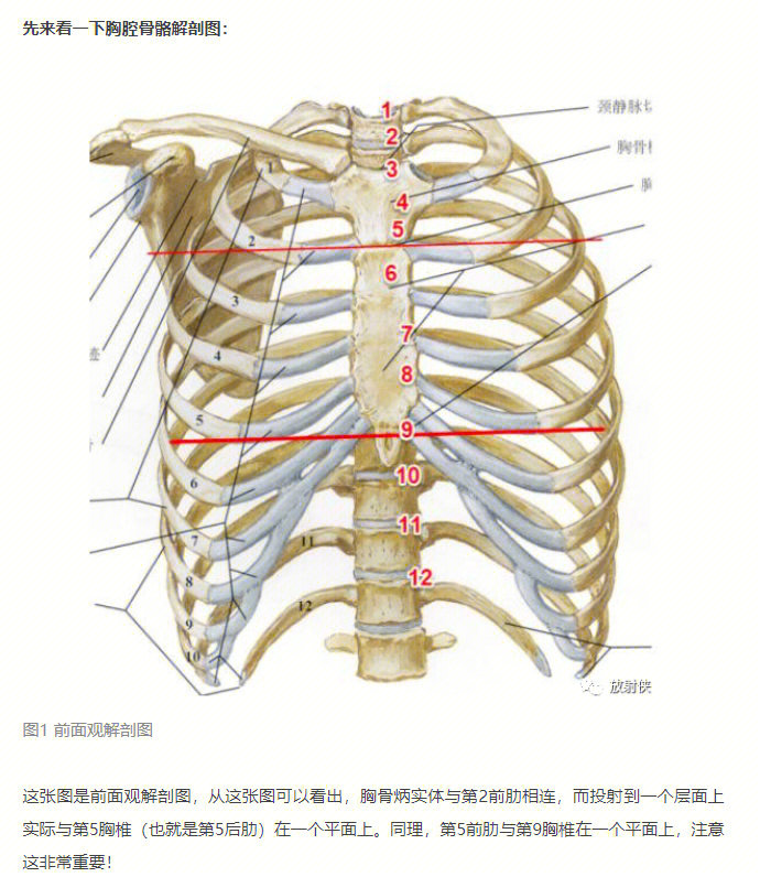 ct平扫胸片怎么看图解图片