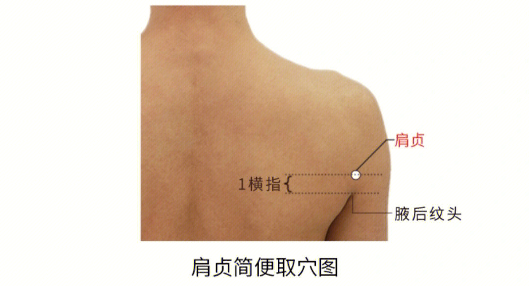 肩贞肩髃肩髎定位图片