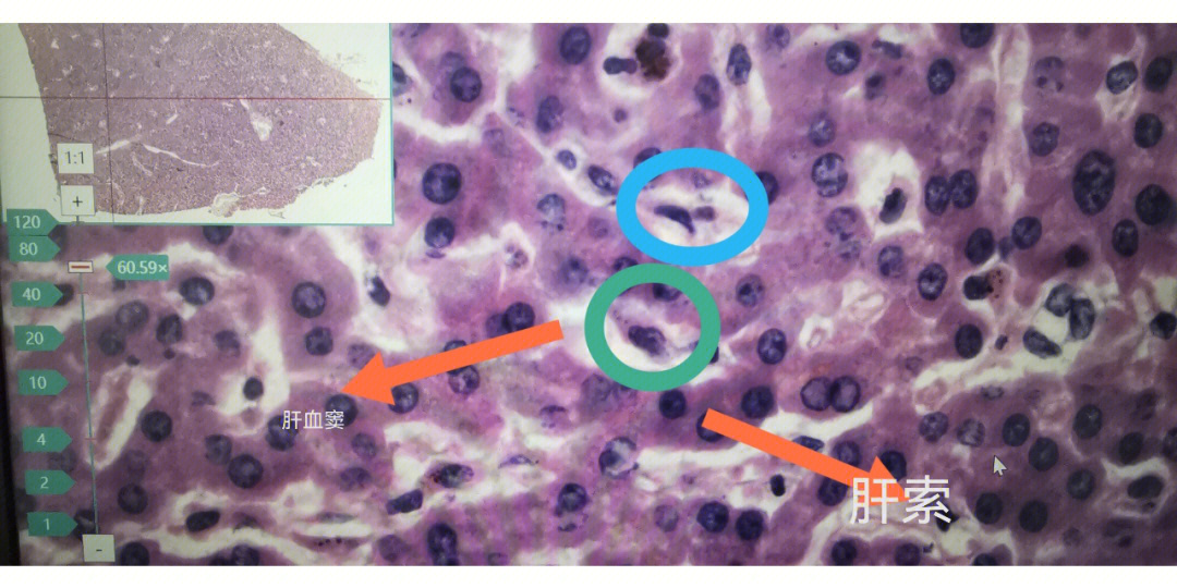 p1:蓝圈是内皮细胞,绿圈是肝巨噬细胞p2:肝门管区的三种管道p3