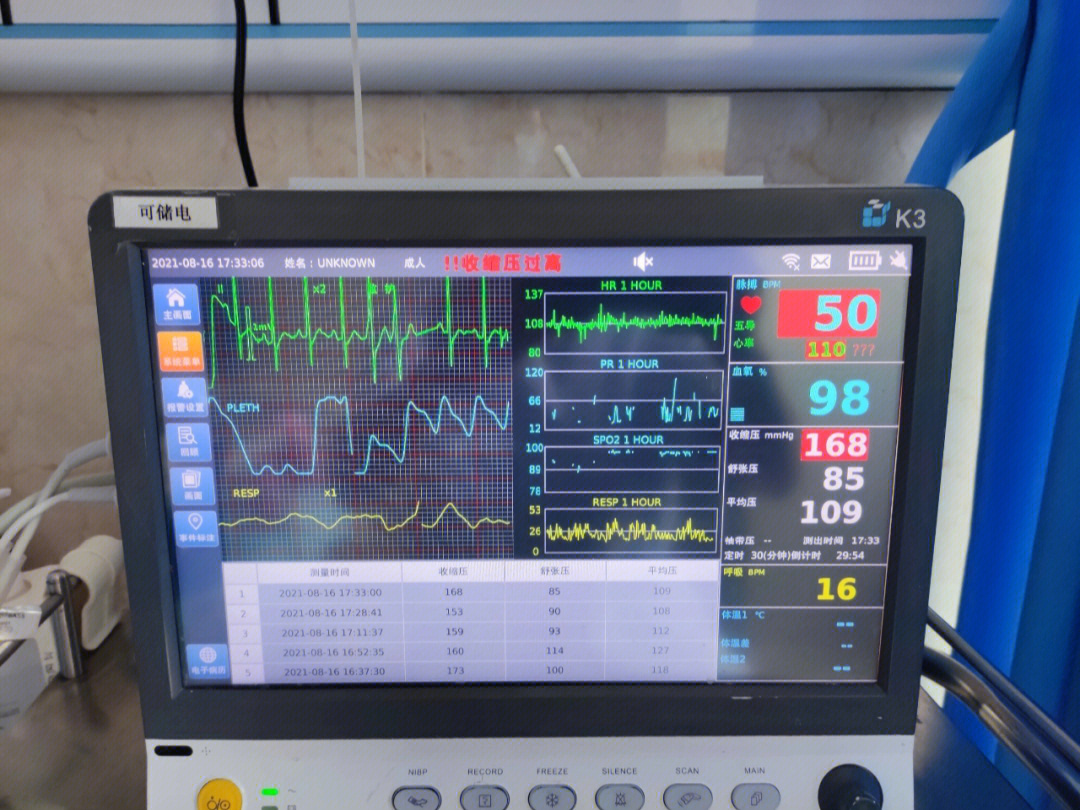 心电监护仪正常值范围图片