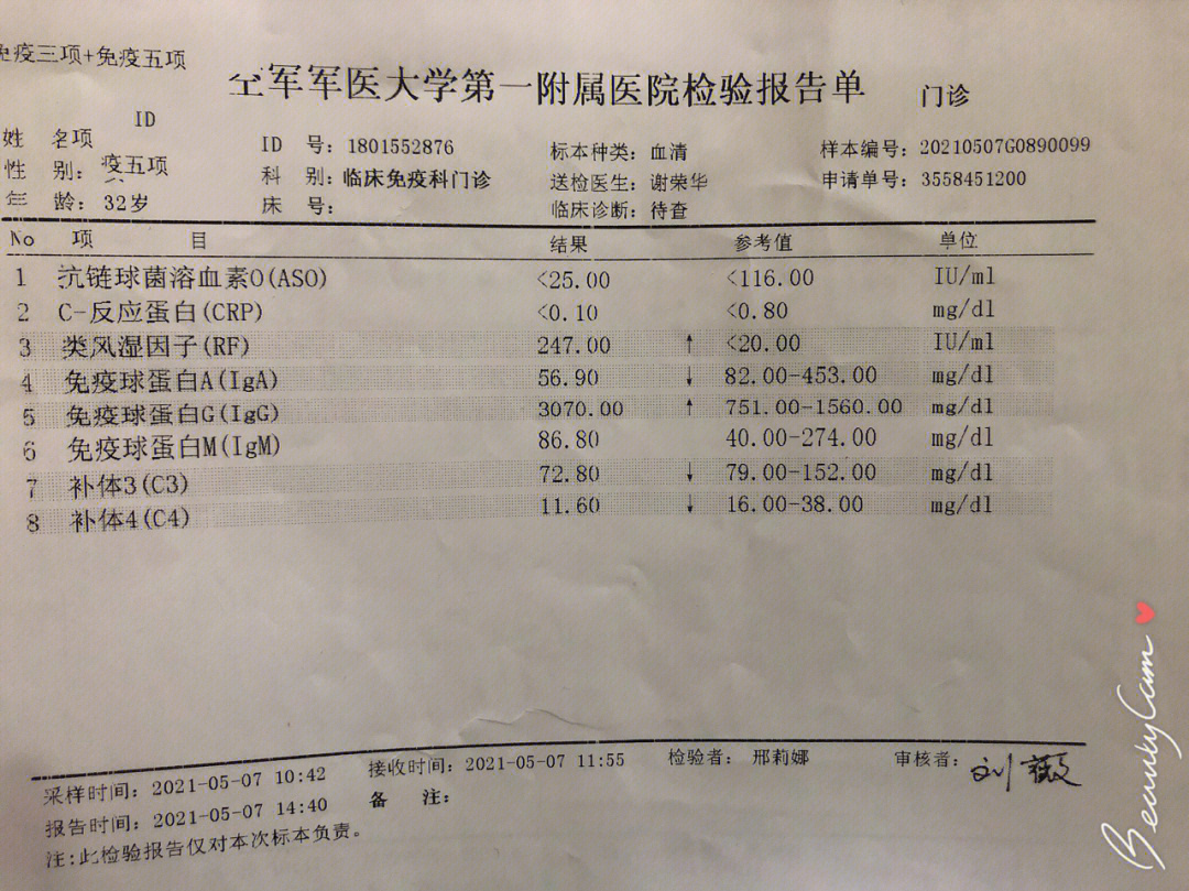 干燥综合症能活多久图片