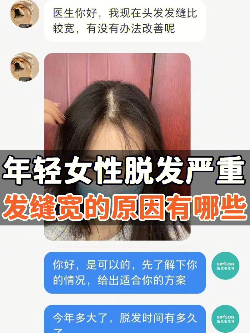 女性脱发严重发缝宽的原因有哪些