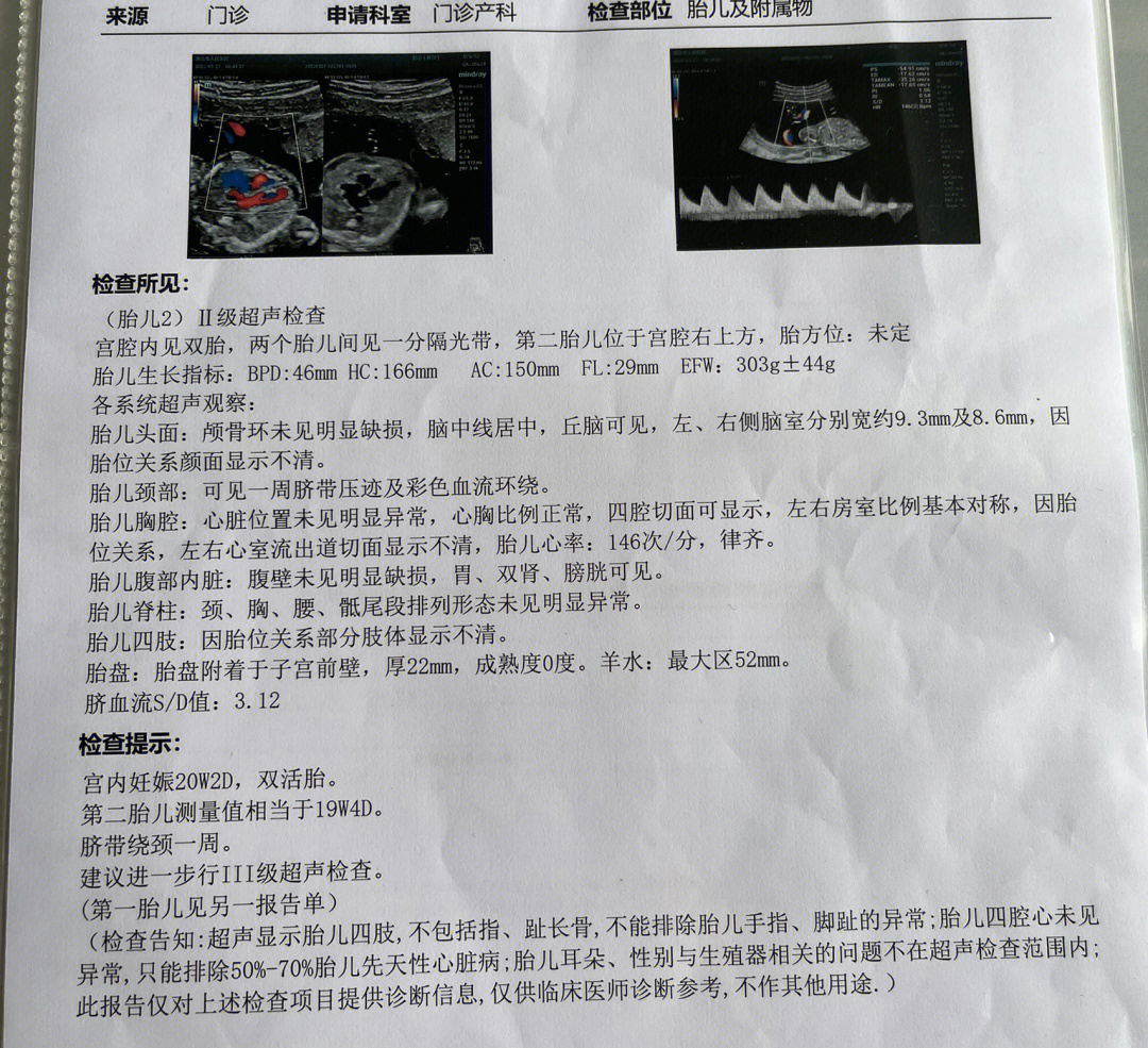 孕20w2单绒双羊侧脑室增宽复测