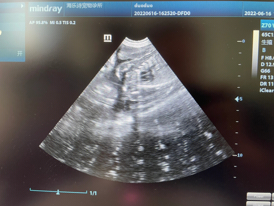 怀孕58天胎儿图图片